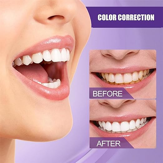 Teeth Colour Corrector